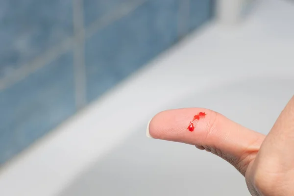 Un dedo herido, gotas de sangre sobre él. — Foto de Stock