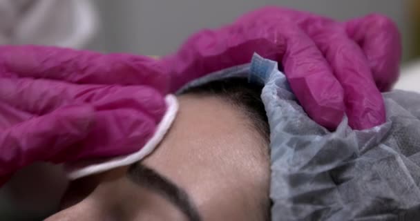 医生用防腐棉垫擦拭病人的额头 然后再注射美容品 美容师用棉垫擦拭女孩的皮肤 — 图库视频影像