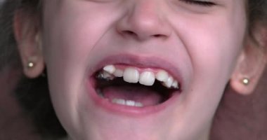 Genç bir kız gülümser ve çarpık dişlerini gösterir. Ağız yakın plan..