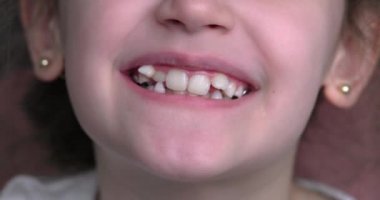 Genç bir kız gülümser ve çarpık dişlerini gösterir. Ağız yakın plan..