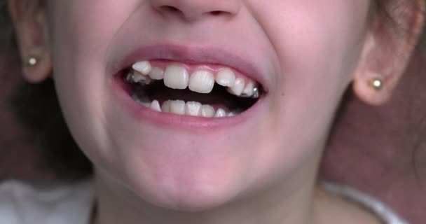 Young Girl Smiles Shows Her Crooked Teeth Mouth Close — Stock Video