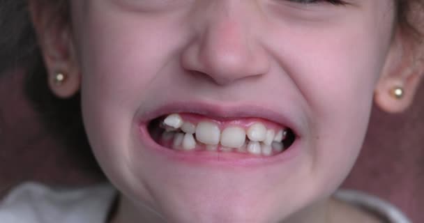 一个年轻姑娘笑了 露出了扭曲的牙齿 嘴巴特写 — 图库视频影像
