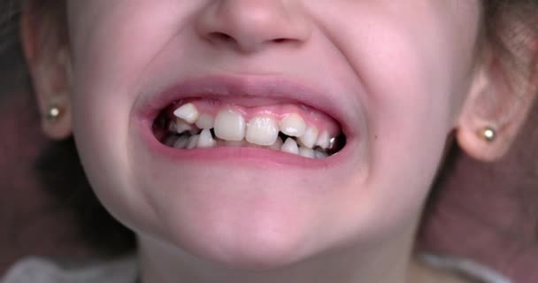 Молодая Девушка Улыбается Показывает Свои Кривые Зубы Рот Крупным Планом — стоковое видео