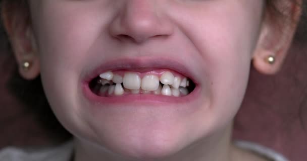 若い女の子が笑顔で曲がった歯を見せてくれます 口を閉じて — ストック動画