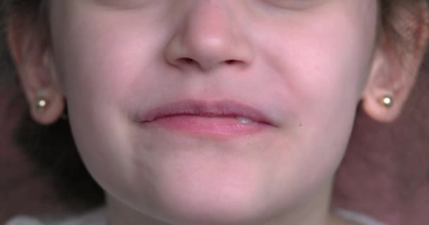 Молода Дівчина Посміхається Показує Свої Криві Зуби Рот Крупним Планом — стокове відео