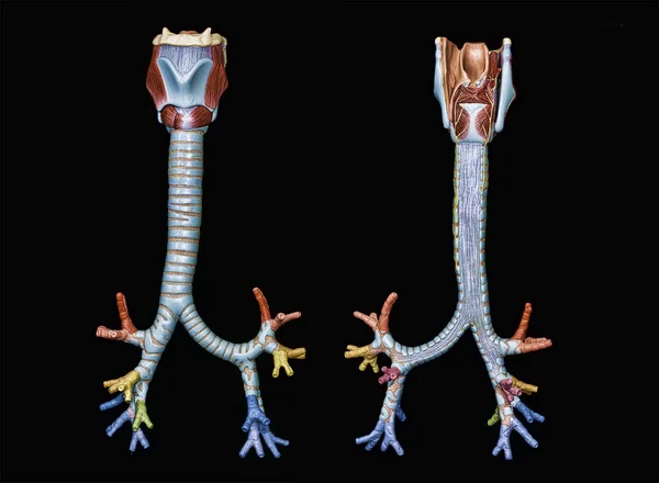 trakeobronşiyal ağacın üzerine siyah izole