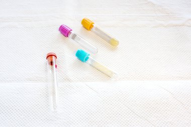 Tek kullanımlık bir yastık üzerinde dört test tüpleri