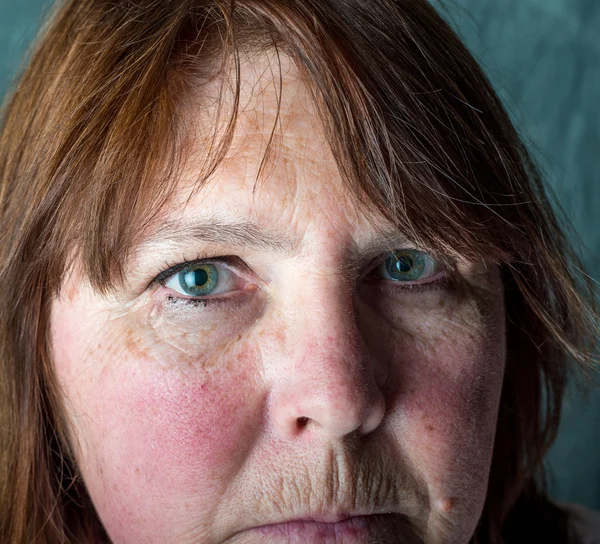 kırık kalpli kadın