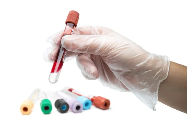 Ręka trzyma krew w probówce i kolorowe rurki badanie — Zdjęcie stockowe