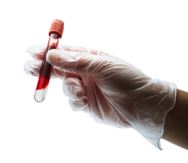 Mano con guante sosteniendo sangre en tubo de ensayo — Foto de Stock