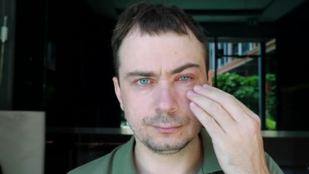 Θλιβερός άνθρωπος αγγίξει σοβαρή bloodshot κόκκινο μάτι του αίματος που επηρεάζεται από Επιπεφυκίτιδα — Αρχείο Βίντεο