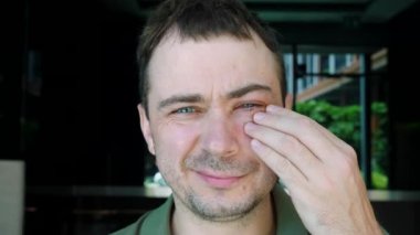 Göz Morluğu, Parlak, Dokunan Ağrı Dokunan Göz İltihabı