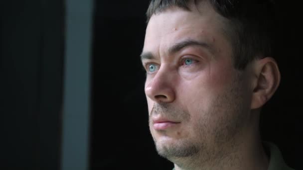 Chory człowiek z jednym zirytowanym czerwonym okiem z objawami zapalenia spojówek — Wideo stockowe