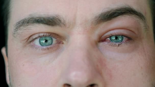 Close-up do homem com um olho infectado inchado com sintoma de conjuntivite — Vídeo de Stock