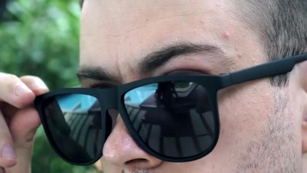 过敏者的近视摘下深色太阳镜，隐藏着游泳的红眼 — 图库视频影像