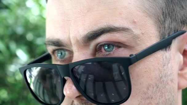 Несчастный серьезный человек прячет красный пушистый глаз с воспалением под зеркальными солнцезащитными очками — стоковое видео