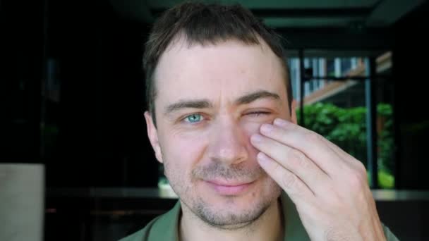 Smutný muž s oteklým bolavým okem se dotkne své tváře rukou a pocitů bolesti — Stock video