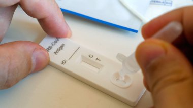 İnsan elleri evde hızlı koronavirüs testi yapmak için dört damla sıvı alır.