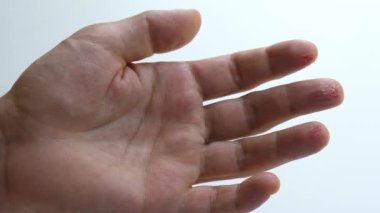 Mens palm hand with injured fingers. Scratched skin bloody wound on fingers with inflammation. Damaged male arm. Fresh red cuts on fingers on white background. Concept of hard manual work. Close-up.