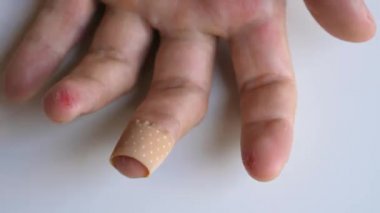 Man putting medical adhesive bandage tape sticking plaster on cuts wound on finger. Male applying band aid patch to injured sore fingers. First aid after accident, self cure concept. Close-up.