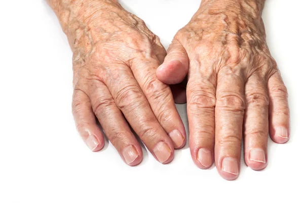 Handen van een oude vrouw — Stockfoto