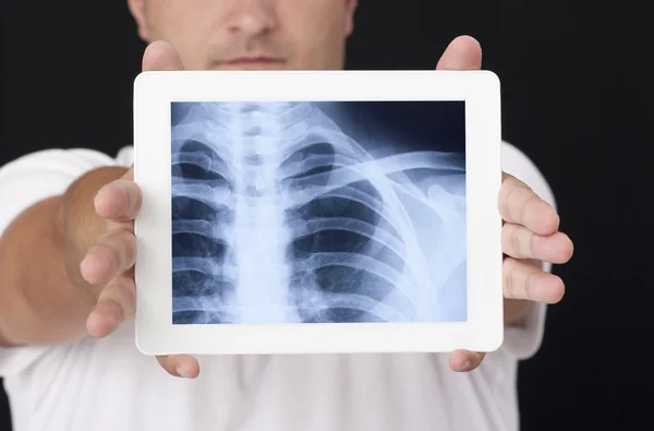 Рентген на цифровом планшете — стоковое фото