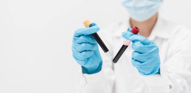 Researchers are studying in vitro blood samples at a medical lab.