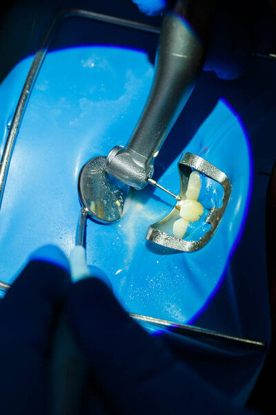 Dentist doctor treats the patient's teeth close-up, how to properly care for the teeth. Dental care and hygiene concept. Selective focus.