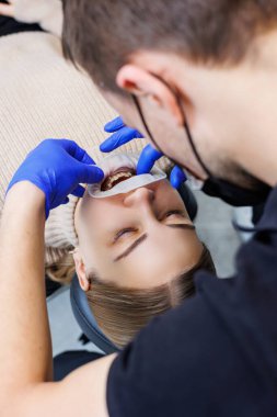 Beyaz dişlerinde diş teli olan kadın dişleri. Bir ortodontist dişlerine diş teli takmak için diş aletleri kullanır. Diş hekimliği konsepti, ortodontik tedavi. Seçici odak