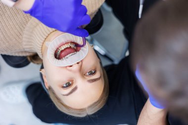 Klinikte metal diş telli bir kadının dişleri tedavi ediliyor. Bir ortodontist dişlerine diş teli takmak için diş aletleri kullanır. Seçici odak