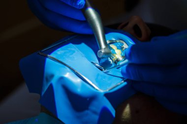 Diş hekimi hastanın dişlerini yakından tedavi eder. Dişlerine nasıl bakacağını bilir. Diş sağlığı ve hijyen konsepti. Seçici odak.