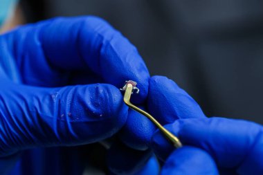 Metal teller, dişlerin üzerine yapıyı bir ortodontistin ellerine takmak için. Ortodontist elinde yeni diş telleri tutuyor ve bir diş kliniğinde bir hasta için hazırlıyor.,