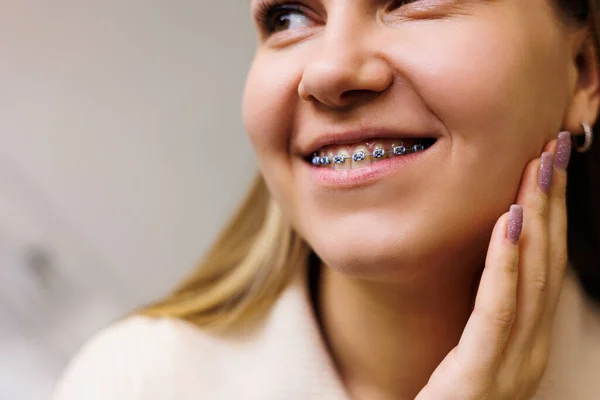 Uma Mulher Com Sorriso Rosto Com Aparelho Nos Dentes Está — Fotografia de Stock