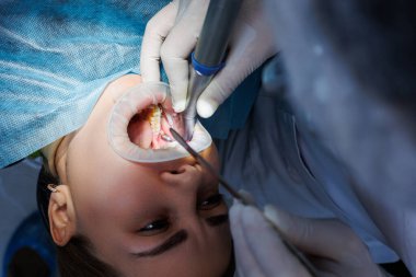 Diş aletleri olan bir diş hekimi, dişçi muayenehanesinde hastanın dişlerini muayene ediyor. Tıp, dişçilik ve sağlık sigortası kavramı. Diş aletleri. seçici odak