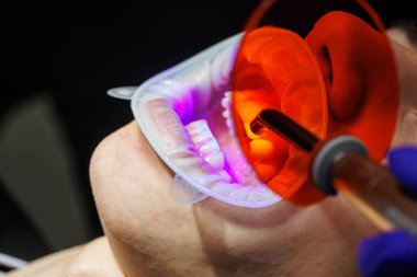 Diş hekimi diş aletini tutarken ağzı açık bir hasta dişçi koltuğunda yatıyor. Modern bir diş kliniğinde diş tedavisi. seçici odak