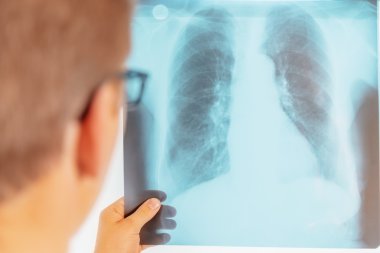 Akciğer röntgeni görüntü doktor görünüyor