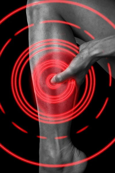 Schmerzen im weiblichen Wadenmuskel — Stockfoto