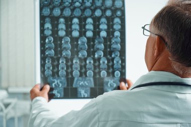 Kıdemli doktor Mr görüntü ele alıyor.