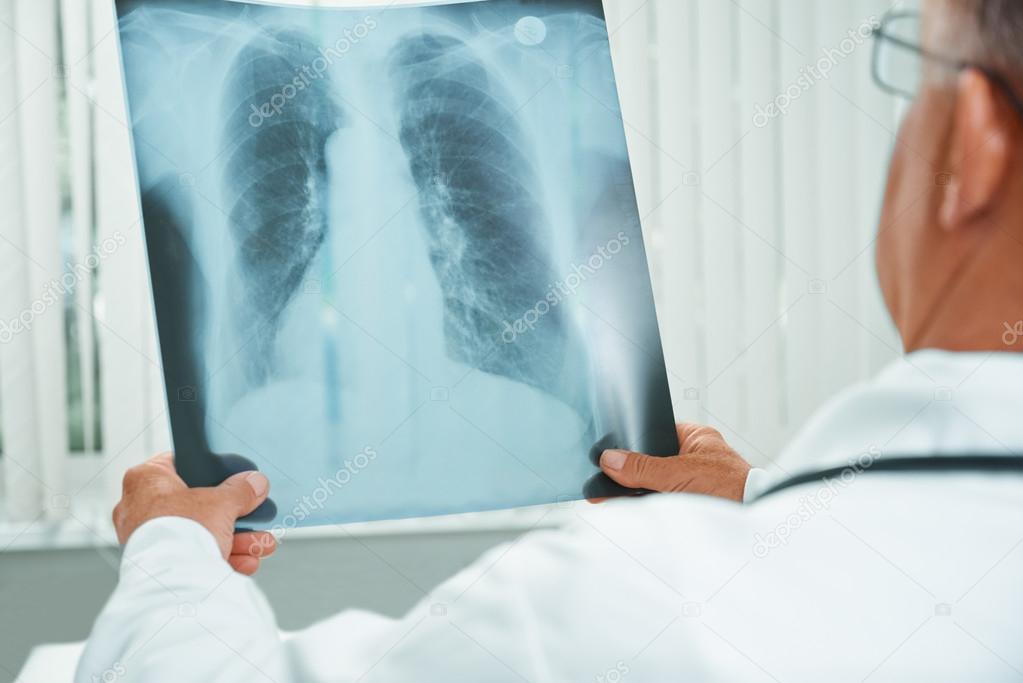 Doctor examines x-ray image