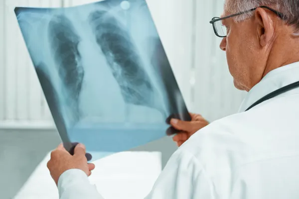 Kıdemli Doktor Röntgen görüntü analiz ediyor - Stok İmaj