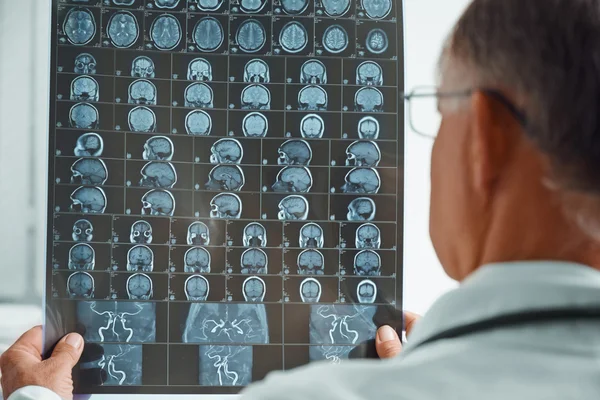 Doctor examines MRI image — Stock Photo, Image
