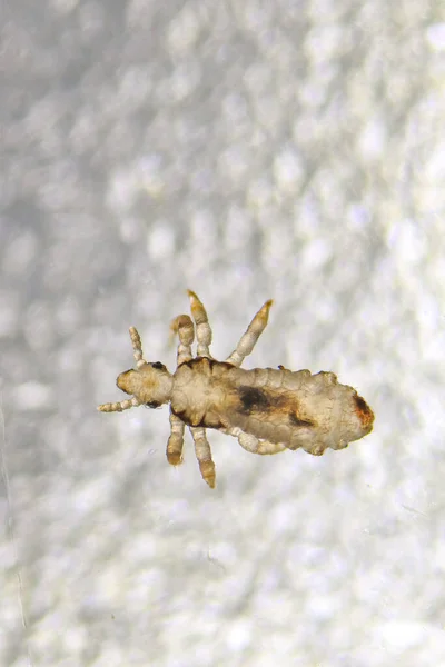 Head Lice Real Extreme Macro Photo Human Infectious Disease Pediculus — Φωτογραφία Αρχείου