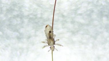 Baş belası insan saçında yürüyor. İnsan parazitinin aşırı yakın plan detayları. Pedikülüs kapititi. İnsan bulaşıcı hastalıklar. Gerçek video. Gerçek video.