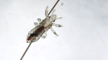 Head louse on a human hair with small head lice walking above her. Extreme closeup detail of human parasite above white background. Real video of movement head lice. Pediculus capitis. Human