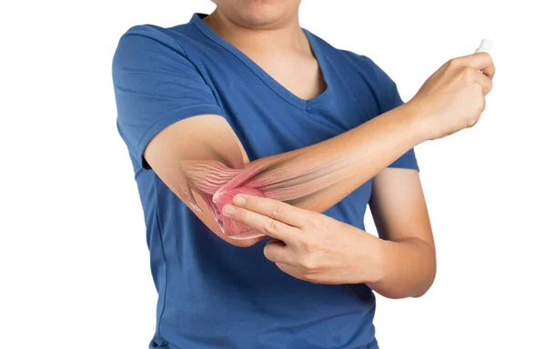 Man Apply Painkillers Elbow Elbow Muscle Pain Inflammation White Background — Stock Photo, Image