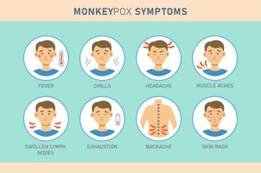 Monkeypox virus  symptoms infographics with icons. Vector flat illustration for medical concept. Design for banner, poster, flyer.