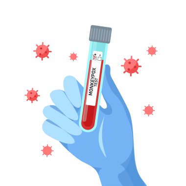 Blood sample tube with hand for  Monkeypox virus test. Vector flat  illustration. Design for medical banner, flyer, card, infographic