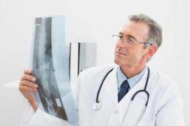 omurga Office x-ışını fotoğrafı bakarak doktor