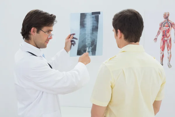 Médico masculino que explica a radiografia da coluna vertebral ao paciente — Fotografia de Stock