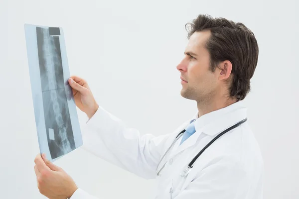 Médecin masculin concentré examinant la radiographie du rachis — Photo